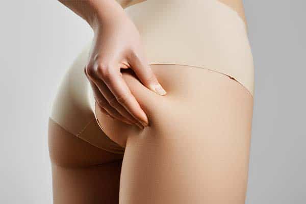 lifting des fesses chirurgie fesses lipofilling fessiers avant apres the body lift francais dr harold chatel docteur taliah schmitt le bodylift francais chirurgien esthetique paris 16